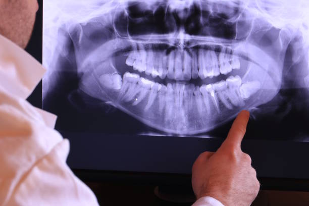 Best Walk-In Emergency Dentist in Oskaloosa, KS