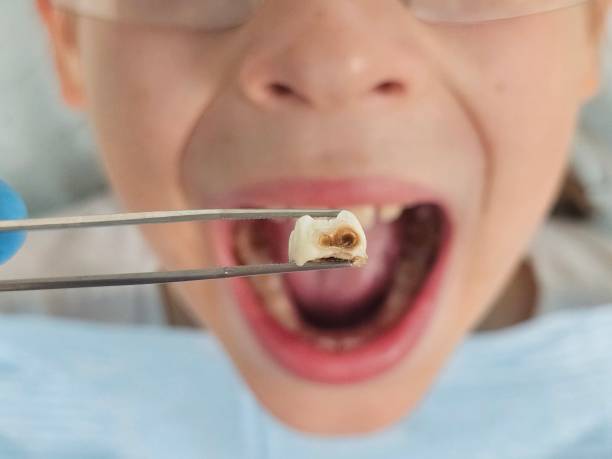 Best Emergency Orthodontic Repairs in Oskaloosa, KS